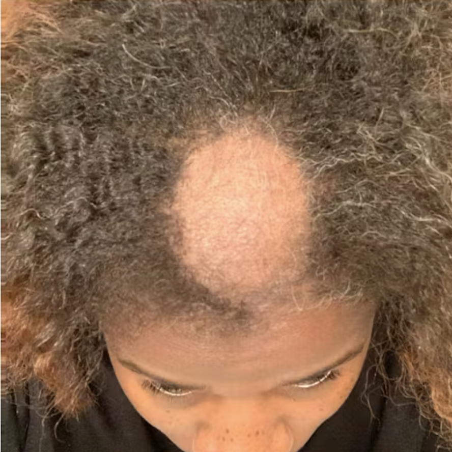 Hair care progress