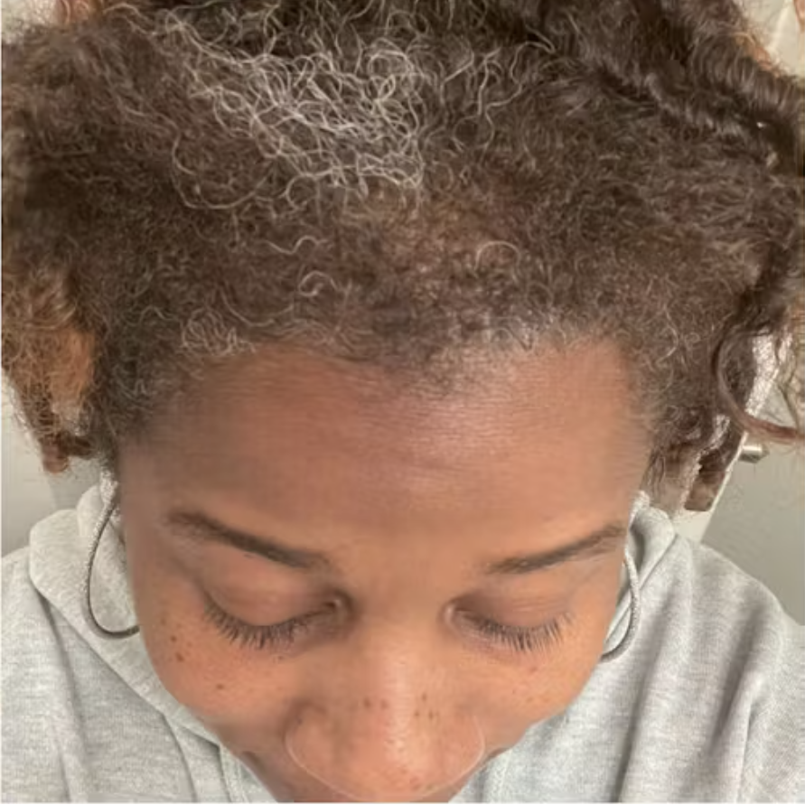 Hair care progress