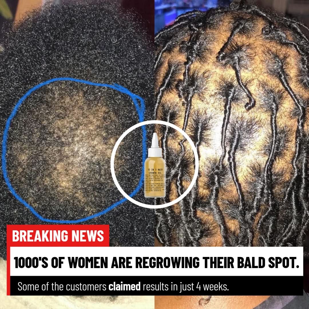 Image of Breakage vs. Shedding: The Real Fix for Thinner-Looking Hair