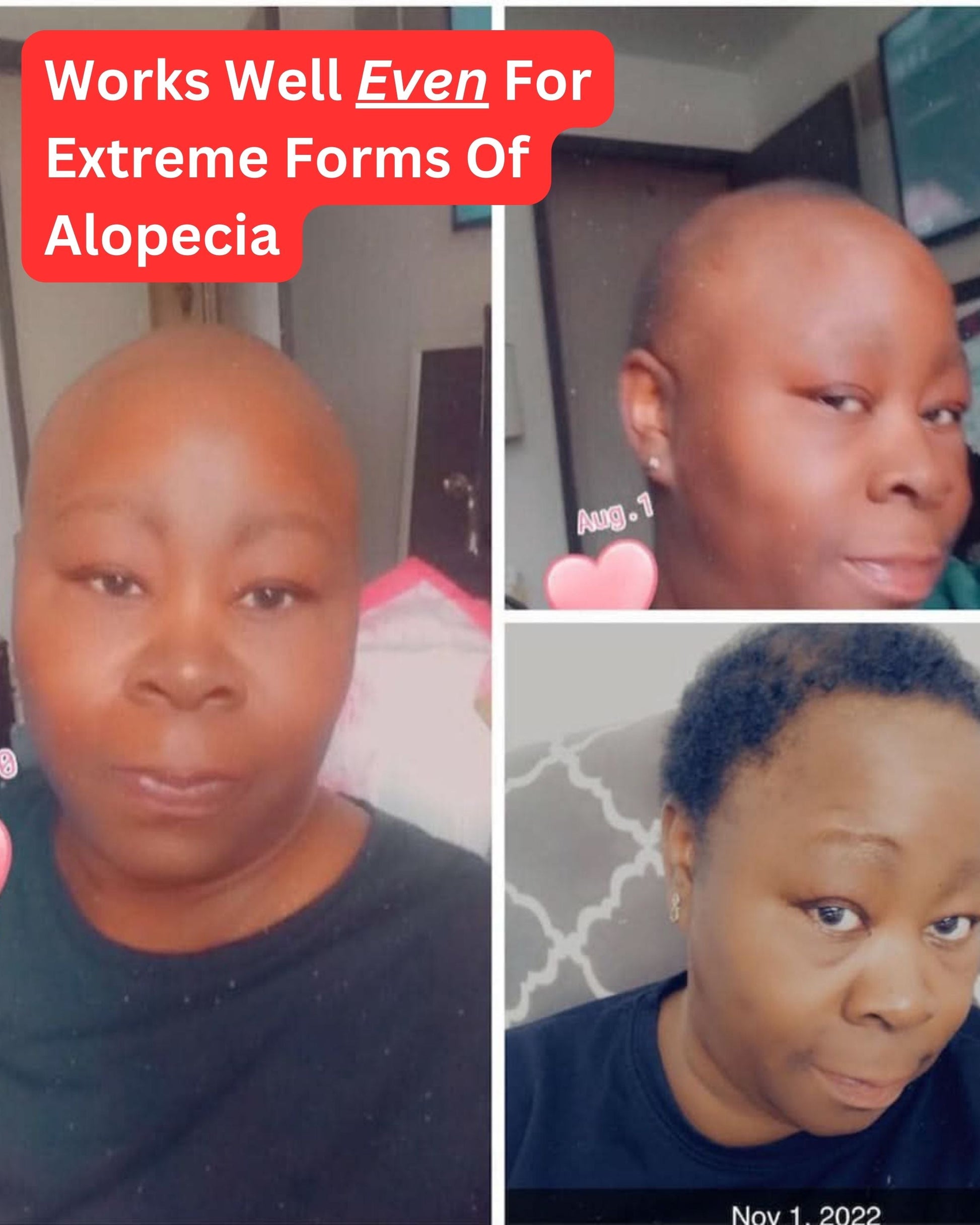 The Extreme Hair Growth Bundle