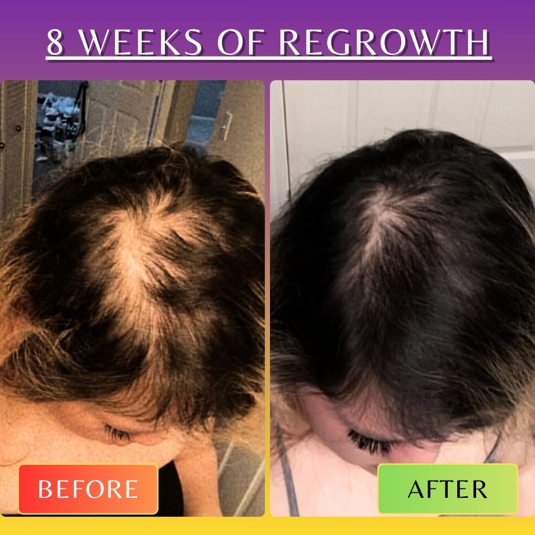 Image of 10 in 1 Hair Growth Oil