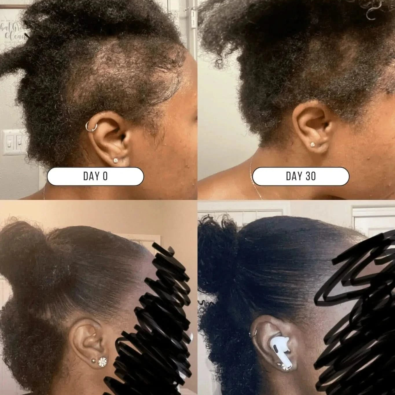 Hair Growth Company