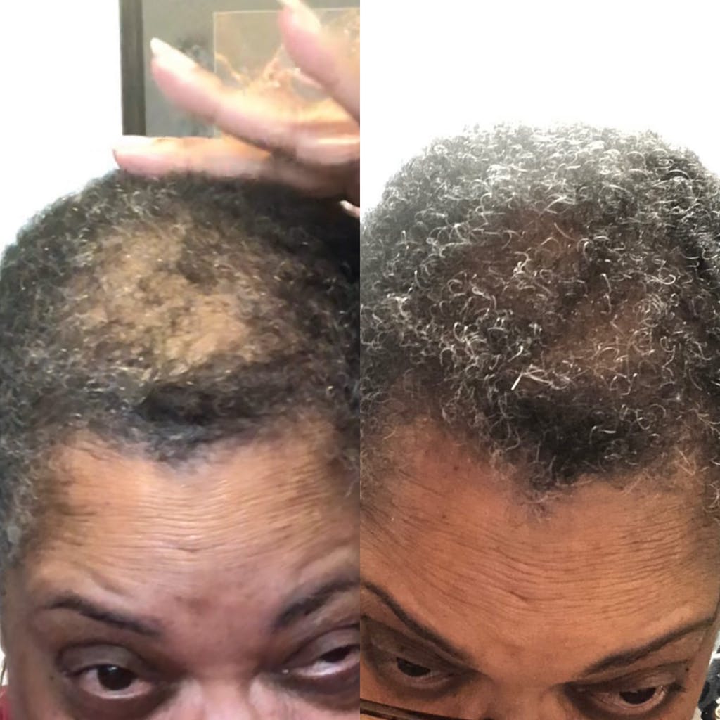 10 in 1 Hair Growth Oil