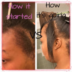10 in 1 Hair Growth Oil