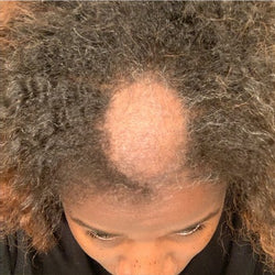Hair Growth Company