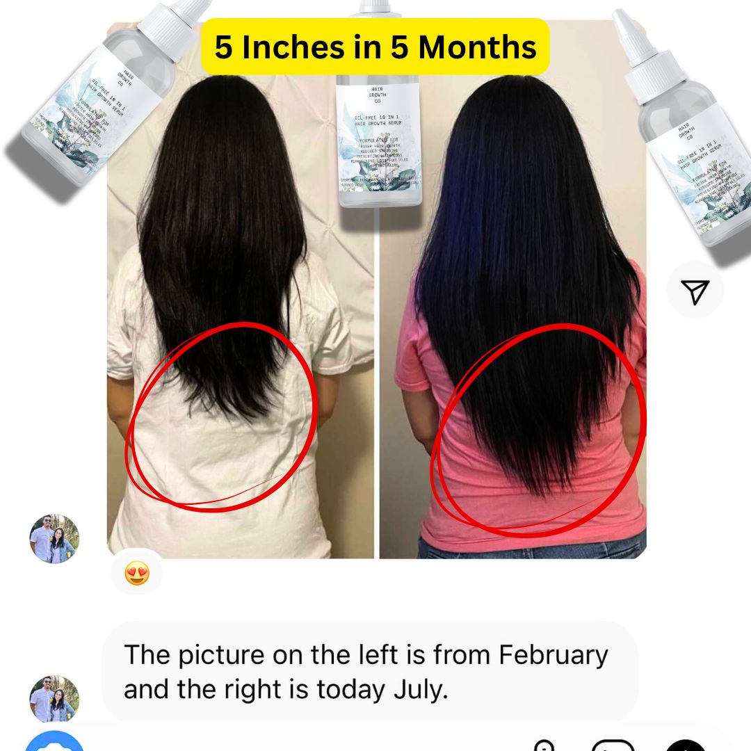 Image of Oil-free 10 in 1 Hair Growth Serum