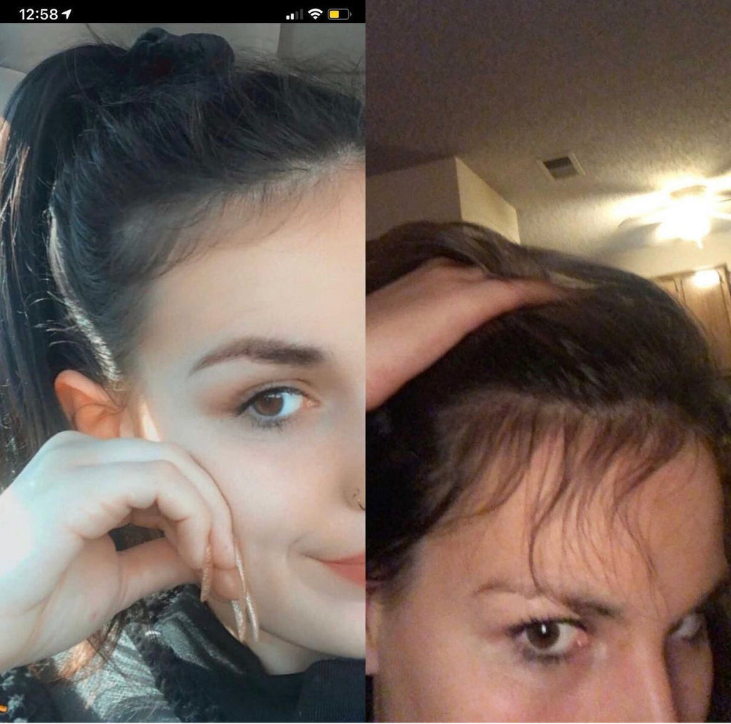 Oil-Free 10 in 1 Hair Growth Serum