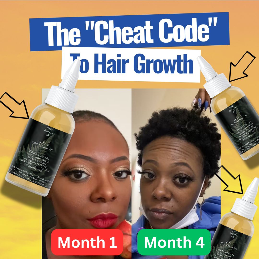 Image of 10 in 1 Hair Growth Oil