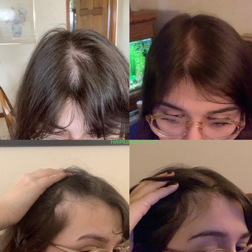 Oil-Free 10 in 1 Hair Growth Serum