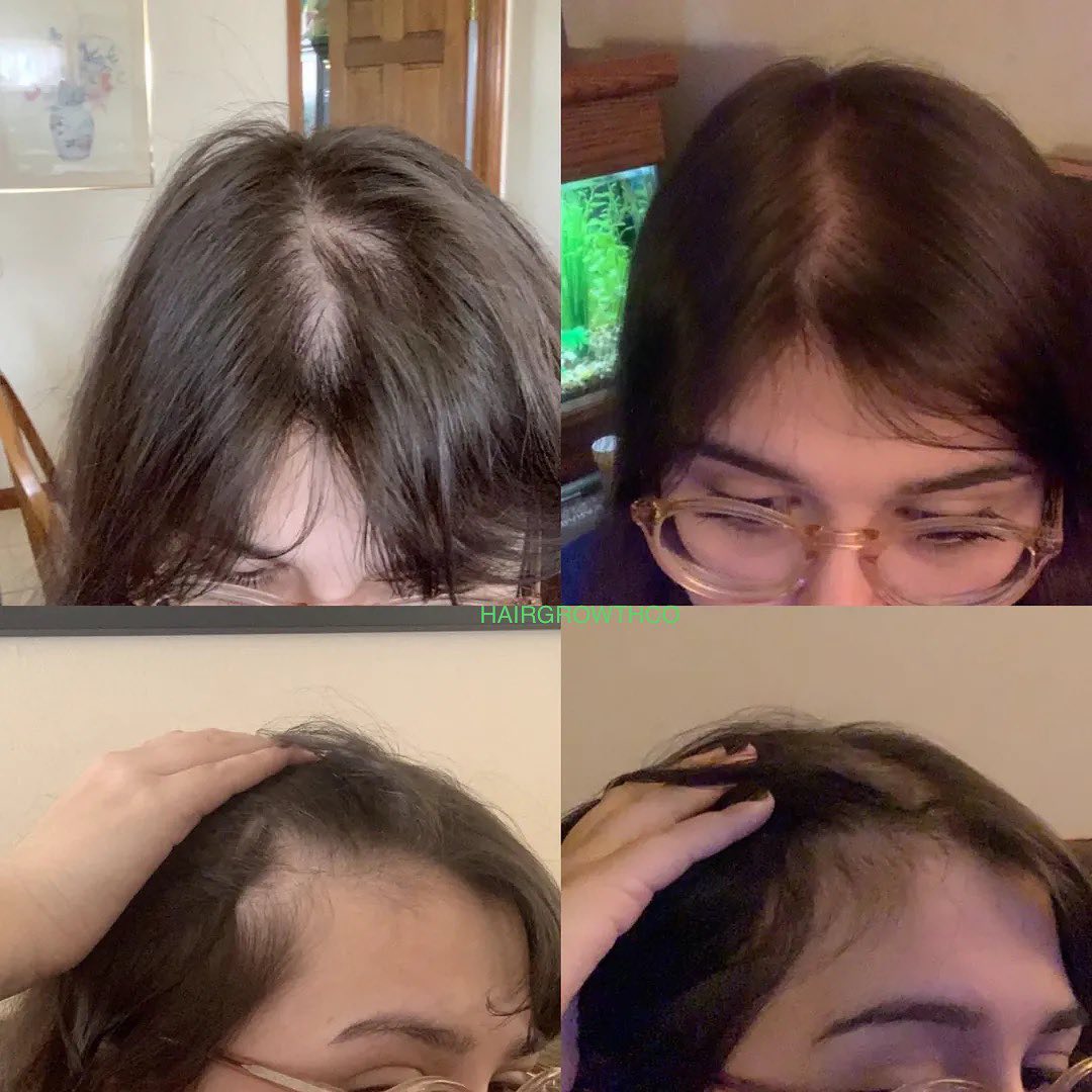 Oil-Free 10 in 1 Hair Growth Serum