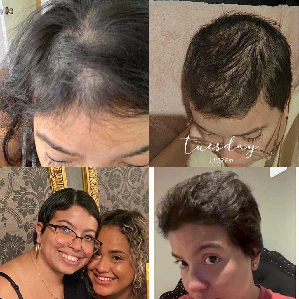 Oil-Free 10 in 1 Hair Growth Serum