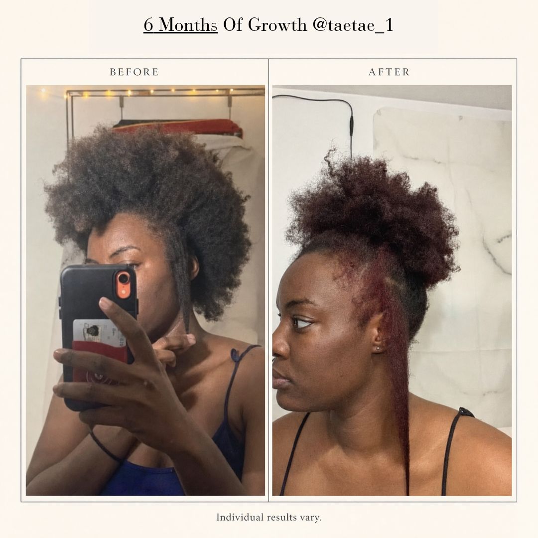 Hair length and retention
