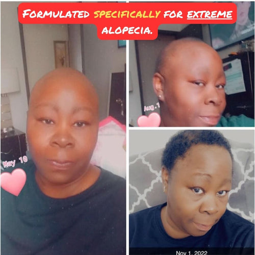 10 in 1 Hair Growth Oil