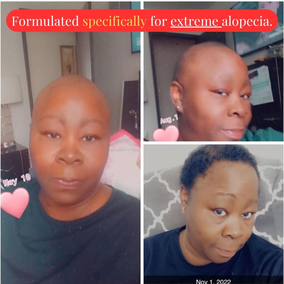 Oil-Free 10 in 1 Hair Growth Serum