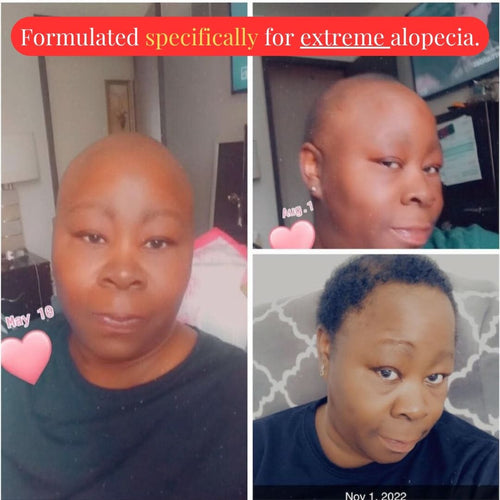 Oil-Free 10 in 1 Hair RE-Growth Serum (For Hair Loss)