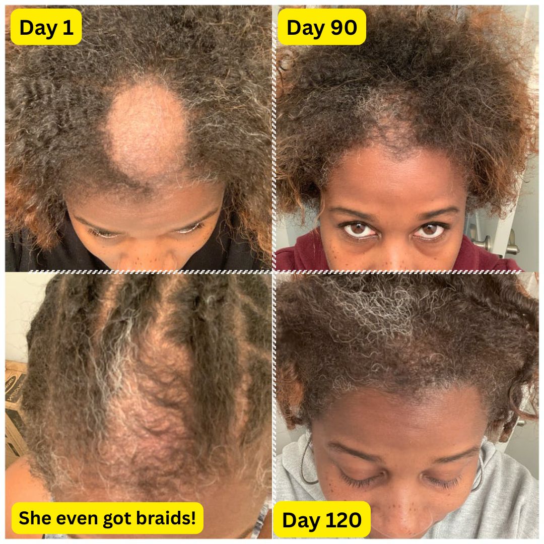 10 in 1 Hair Growth Oil