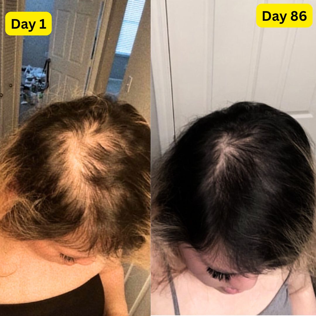 (BULK)(4-PACK) Oil-free 10 in 1 Hair Growth Serum