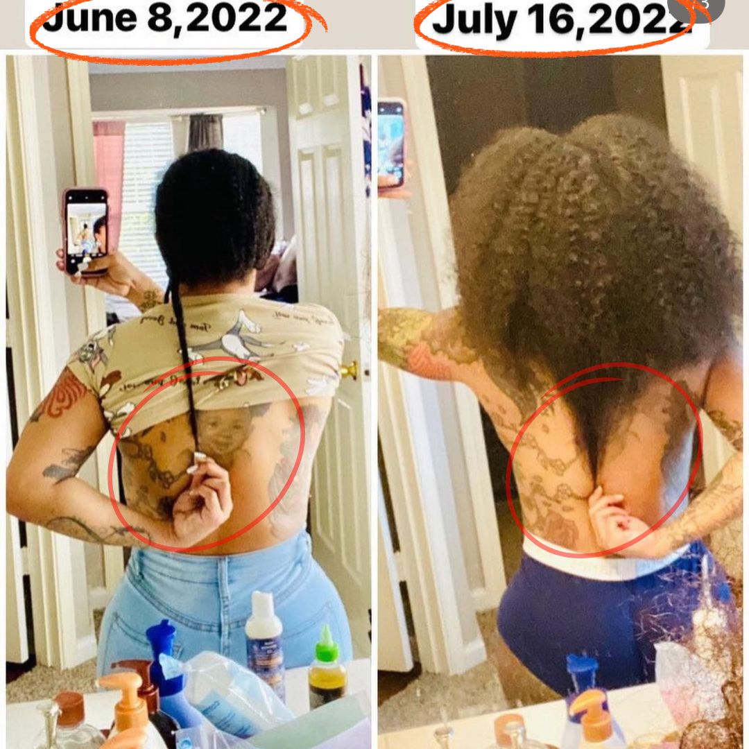 10 in 1 Hair Growth Oil