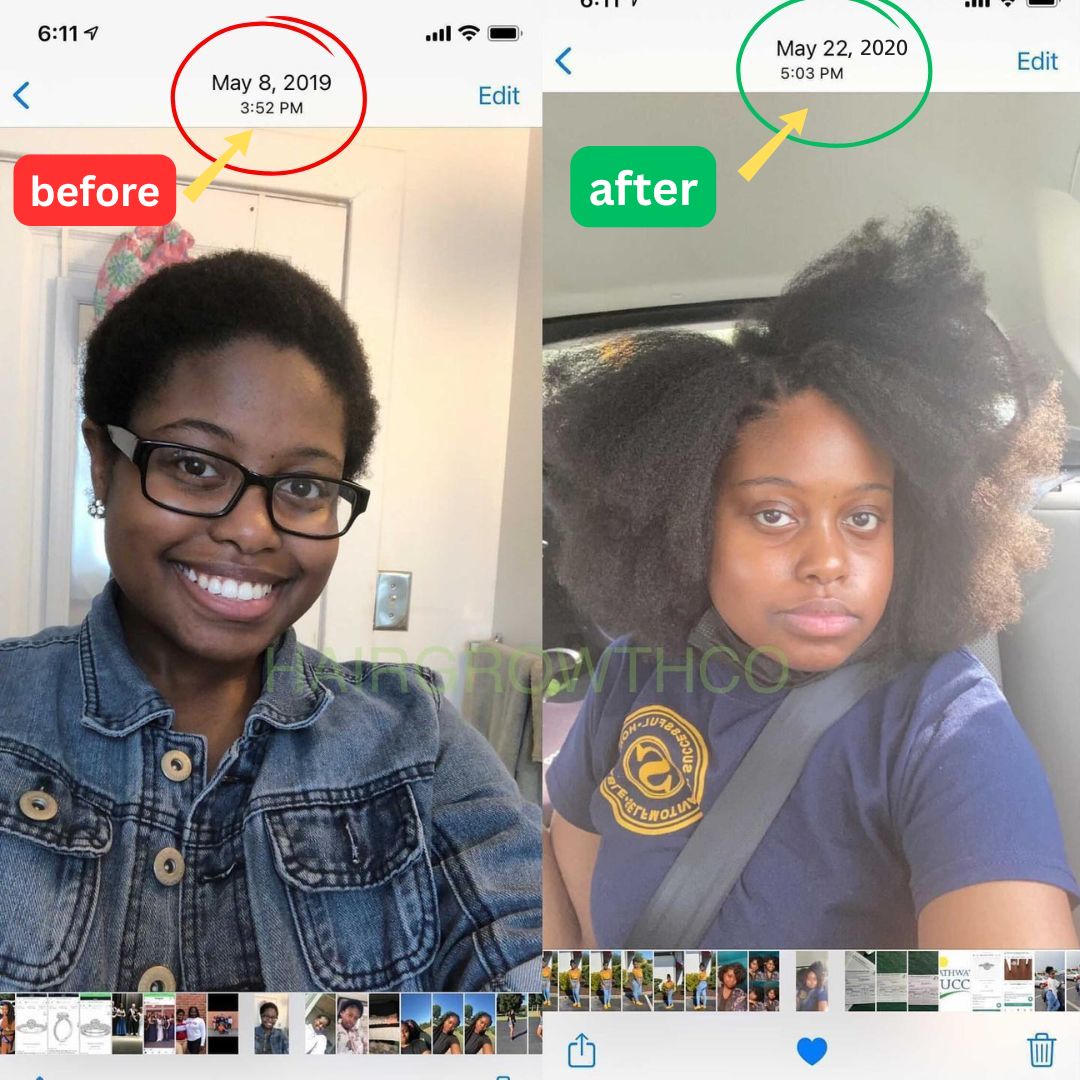 Image of 10 in 1 Hair Growth Oil