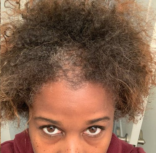 Hair Growth Company