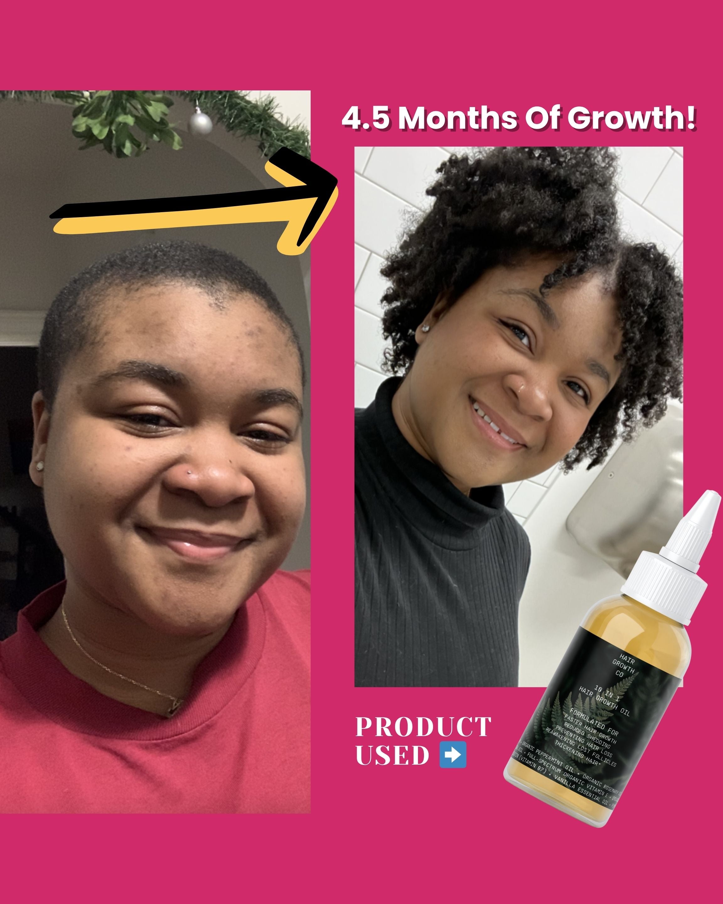 10 in 1 Hair Growth Oil