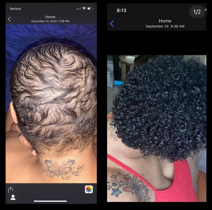 Hair Growth + Regrowth Gummy Vitamin (1-Month Supply)
