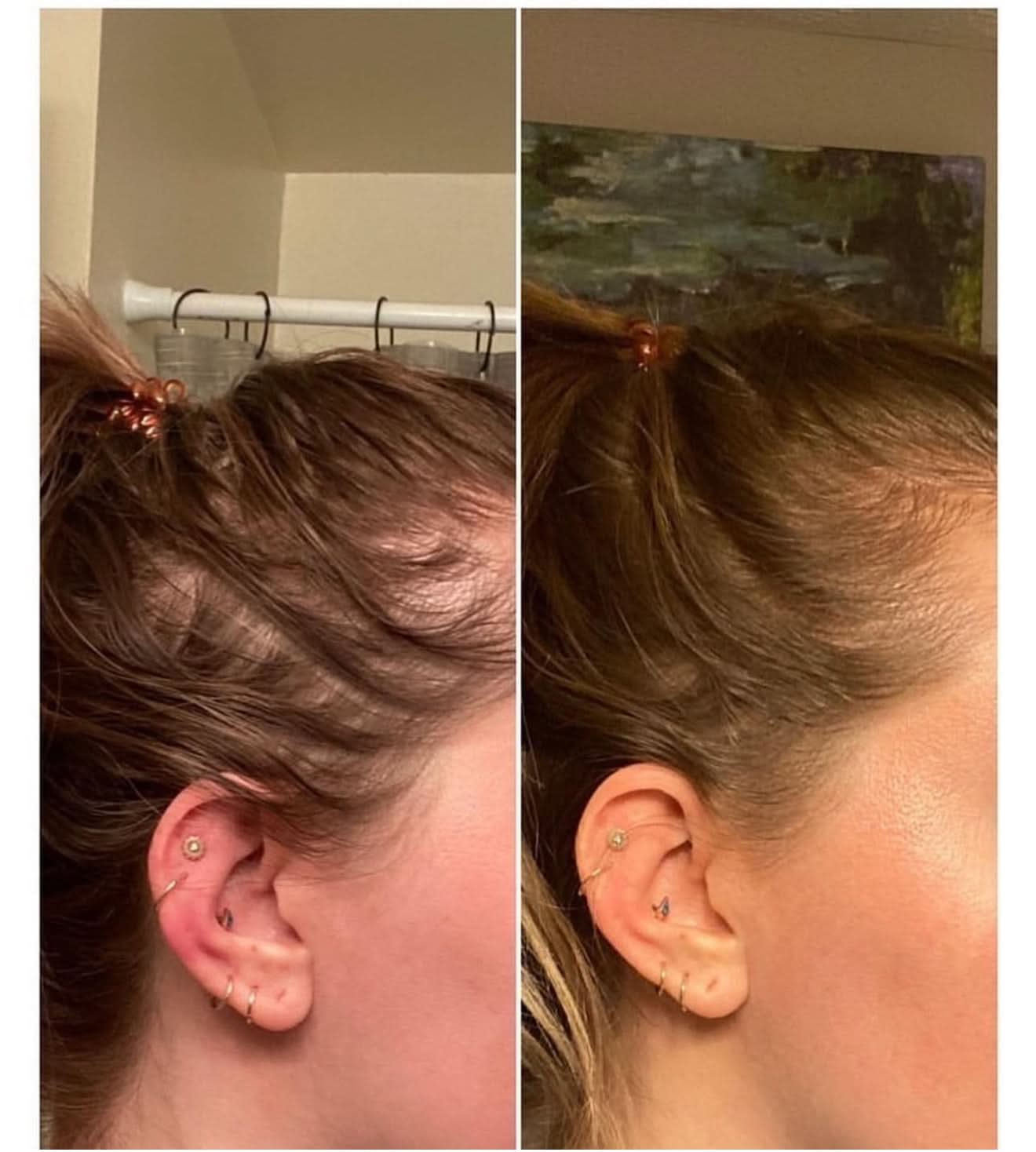 Image of Hair Growth + Regrowth Gummy Vitamin (1-Month Supply)