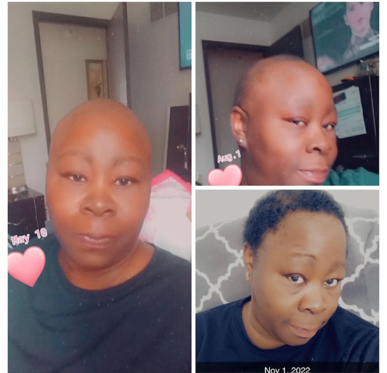 Hair Growth + Regrowth Gummy Vitamin (1-Month Supply)
