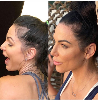Hair Growth + Regrowth Gummy Vitamin (1-Month Supply)