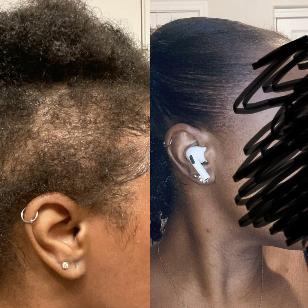 Oil-Free 10 in 1 Hair Growth Serum