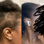 Oil-Free 10 in 1 Hair Growth Serum