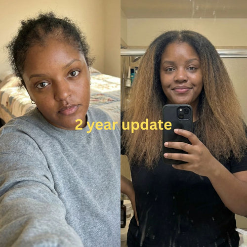 10 in 1 Hair Growth Oil (For Faster Growth)