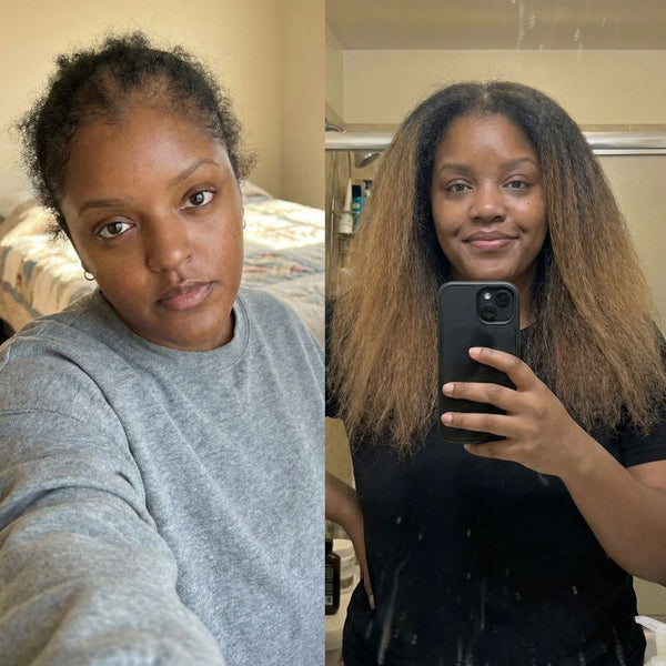 I grew waist length hair in just 2 years.