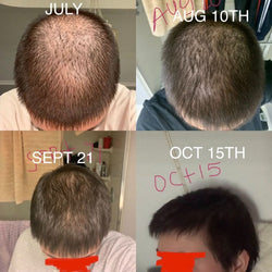 Image of Hair Growth + Regrowth Gummy Vitamin (1-Month Supply)