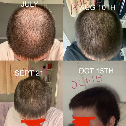 Hair Growth + Regrowth Gummy Vitamin (1-Month Supply)