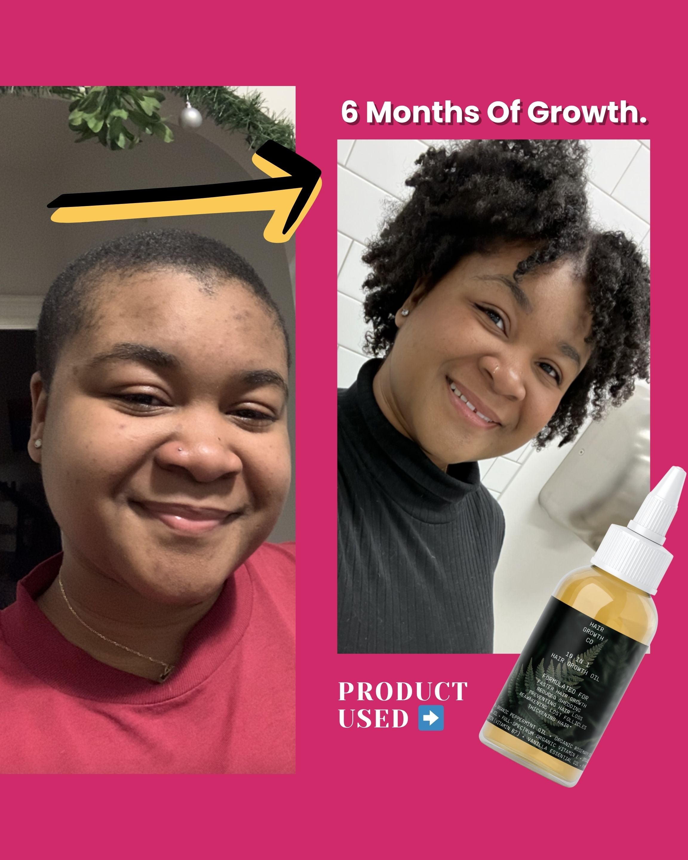 Image of 10 in 1 Hair Growth Oil