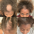Oil-Free 10 in 1 Hair Growth Serum