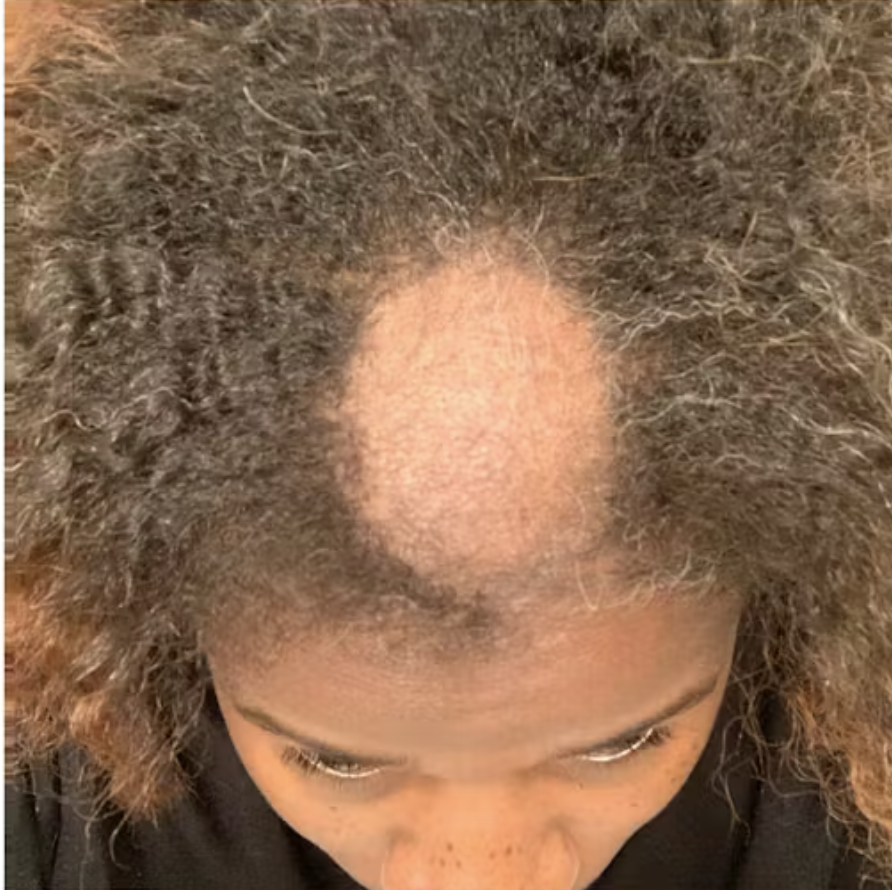 10 in 1 Hair Growth Oil