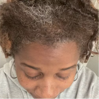 10 in 1 Hair Growth Oil