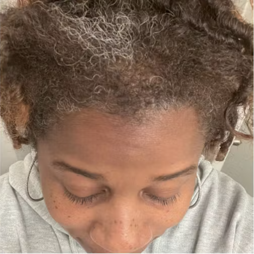 10 in 1 Hair Growth Oil