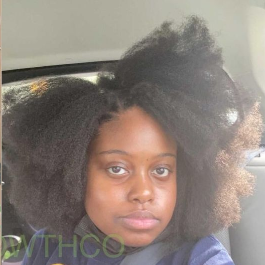 10 in 1 Hair Growth Oil