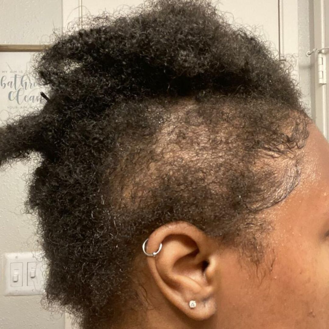 Hair Growth Company