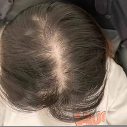 Hair Growth Company