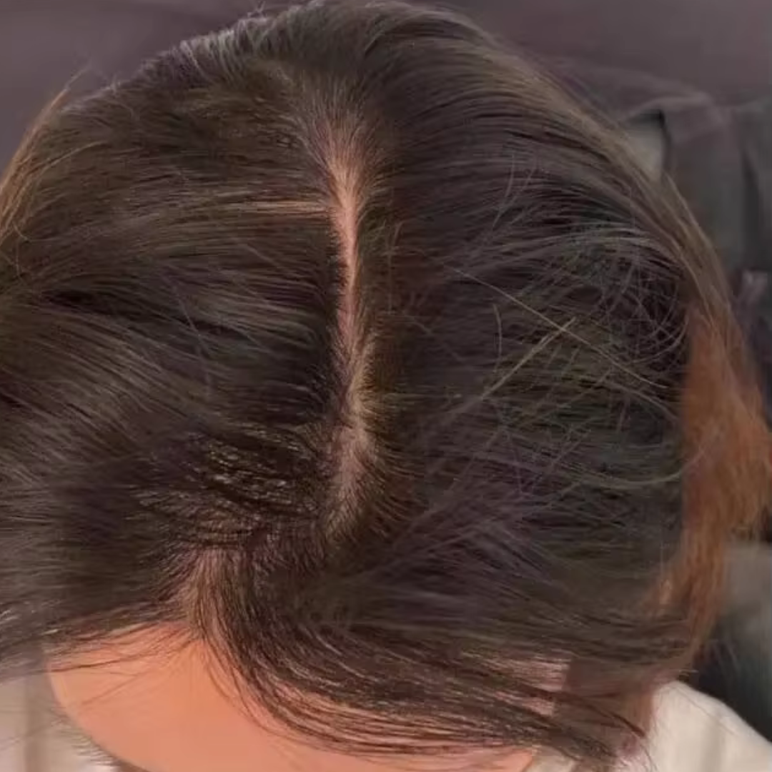 Hair Growth Company