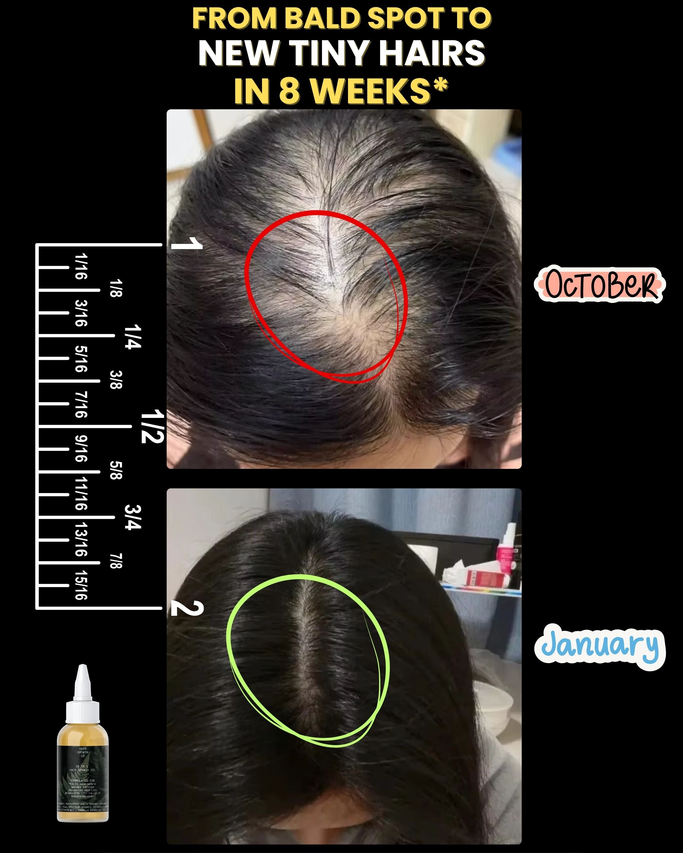10 in 1 Hair Growth Oil