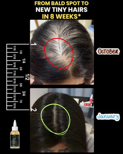 Image of 10 in 1 Hair Growth Oil