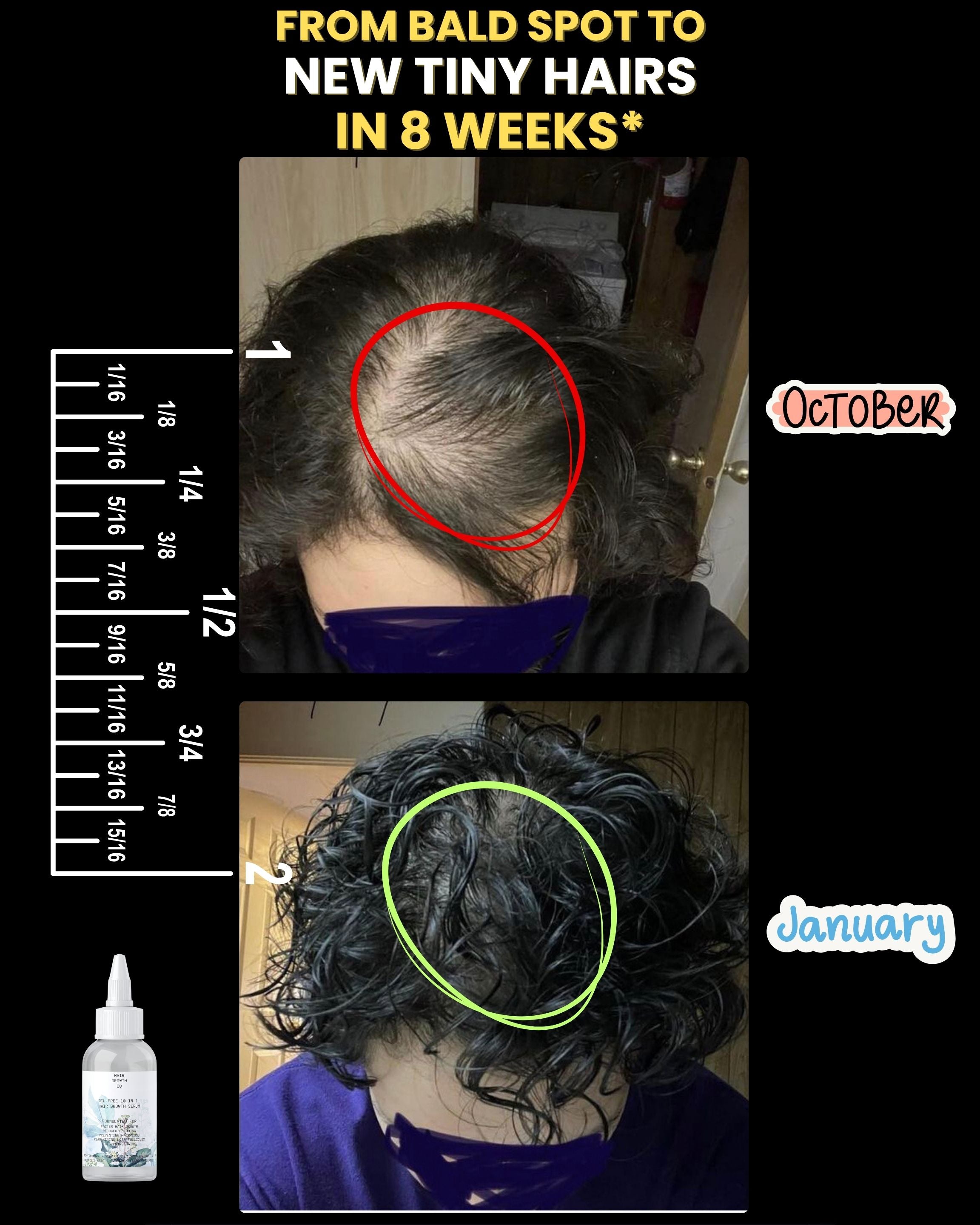 Oil-free 10 in 1 Hair RE-Growth Serum