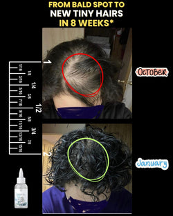 Image of Oil-free 10 in 1 Hair RE-Growth Serum
