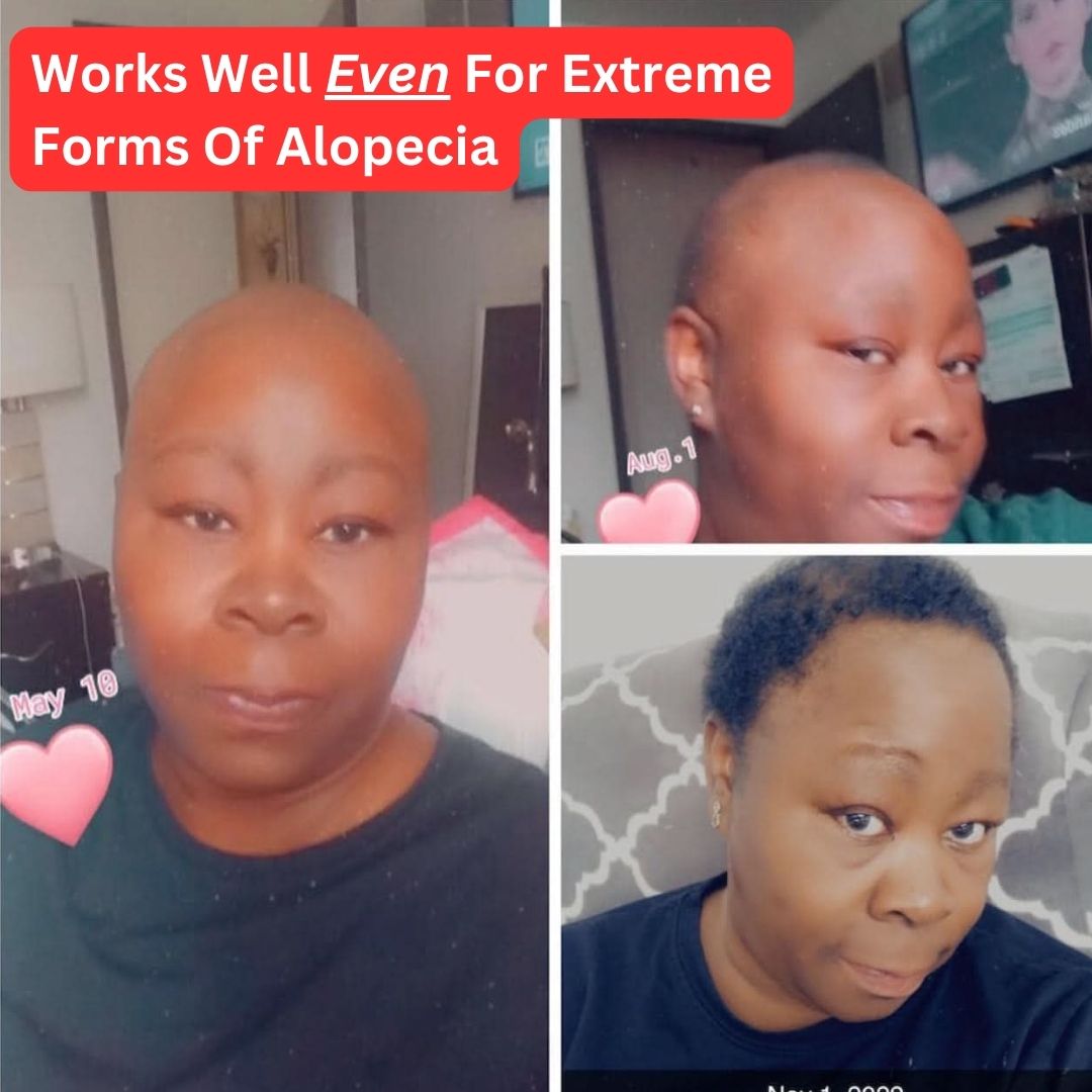 10 in 1 Hair Growth Oil