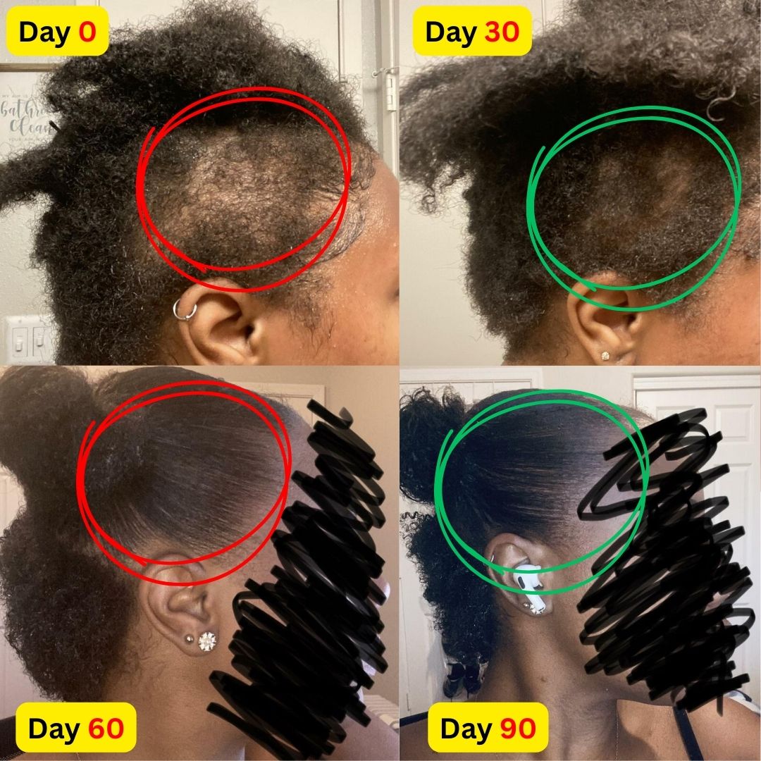 Image of 10 in 1 Hair Growth Oil